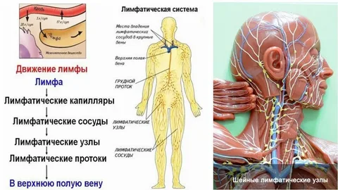 застой лимфы